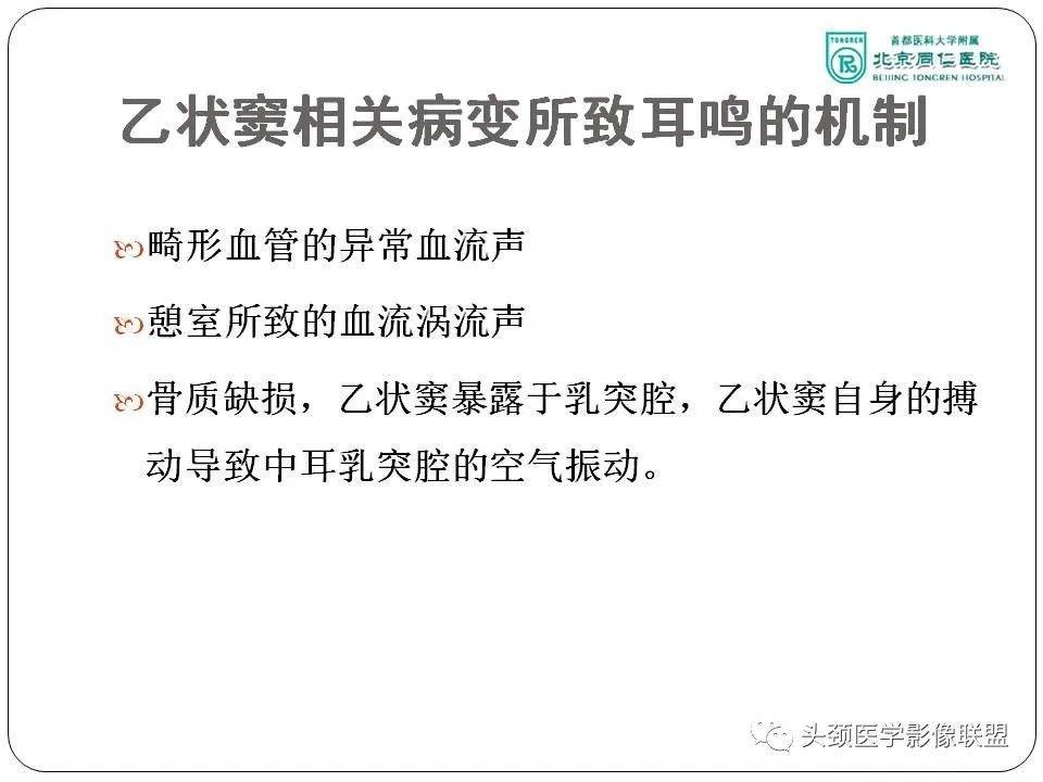 影像PPT - 【PPT】搏动性耳鸣诊疗进展-34