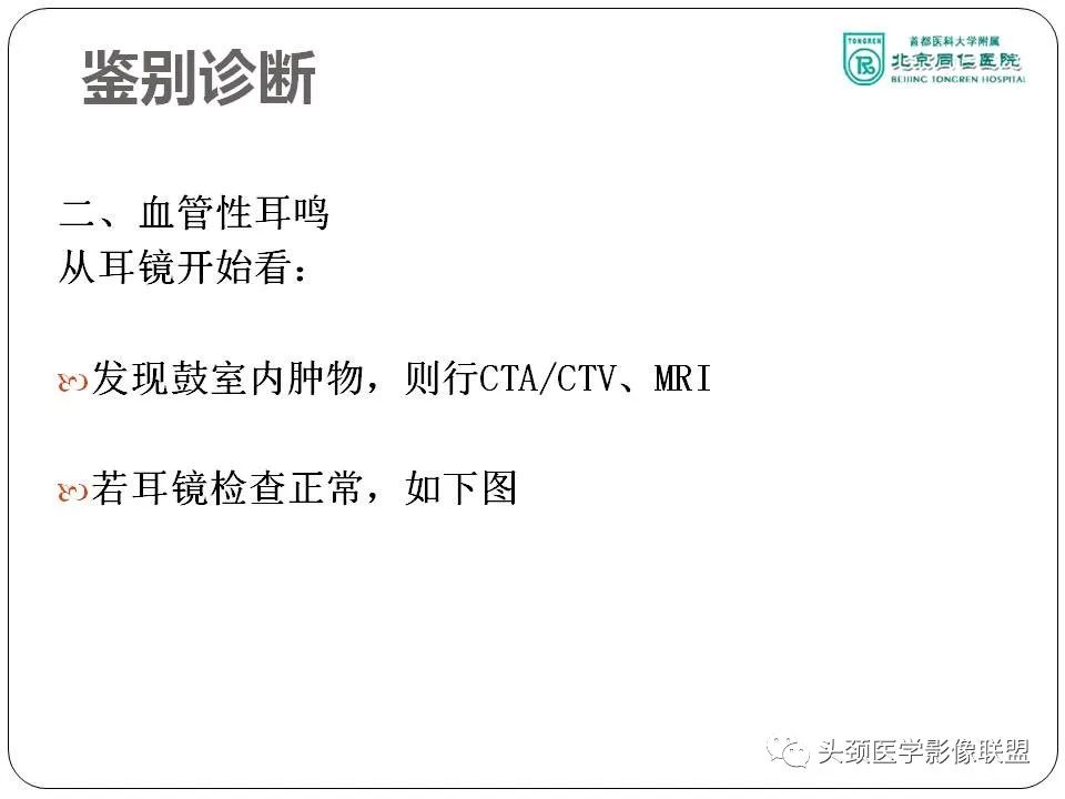 影像PPT - 【PPT】搏动性耳鸣诊疗进展-53