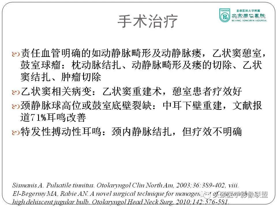 影像PPT - 【PPT】搏动性耳鸣诊疗进展-60
