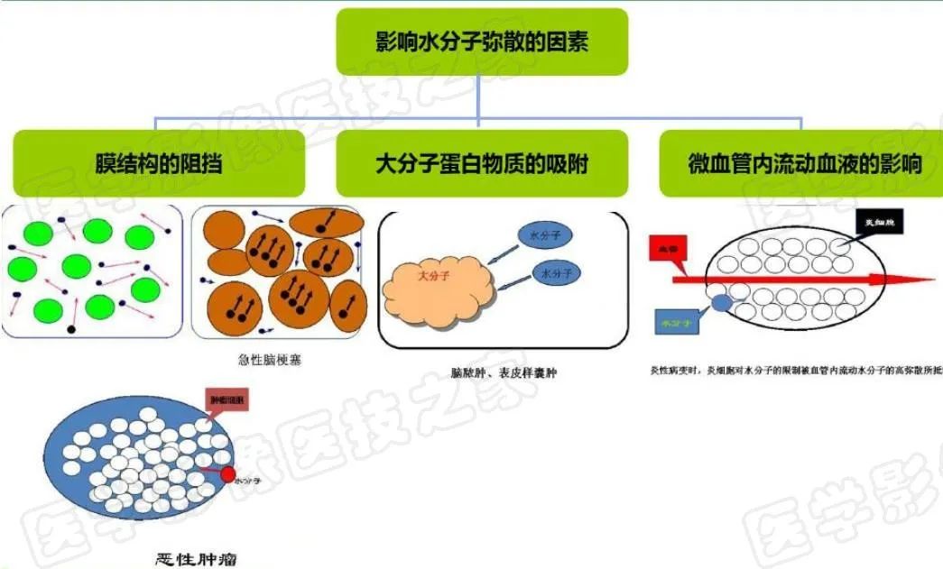 影像PPT - 【PPT】脑梗在磁共振弥散图像上信号的演变过程-3