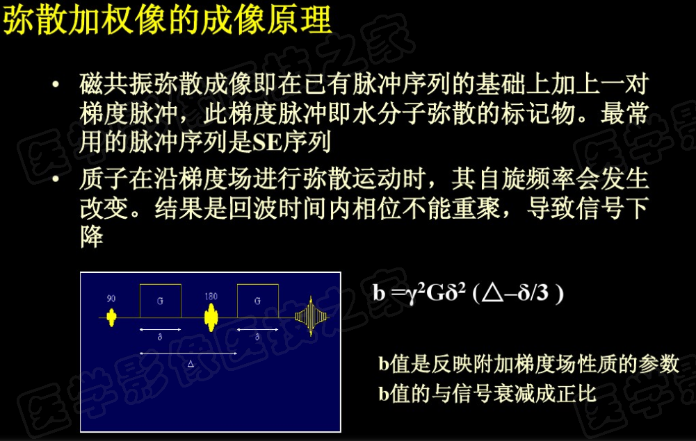 影像PPT - 【PPT】脑梗在磁共振弥散图像上信号的演变过程-4