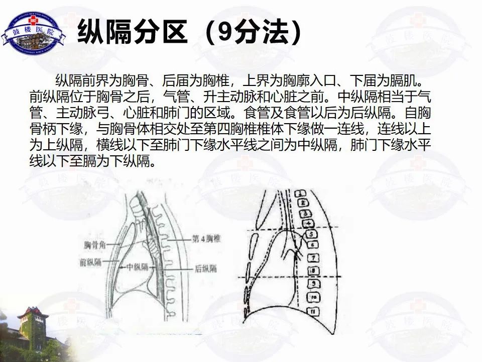 影像PPT - 【PPT】纵隔囊性病变CT诊断-11