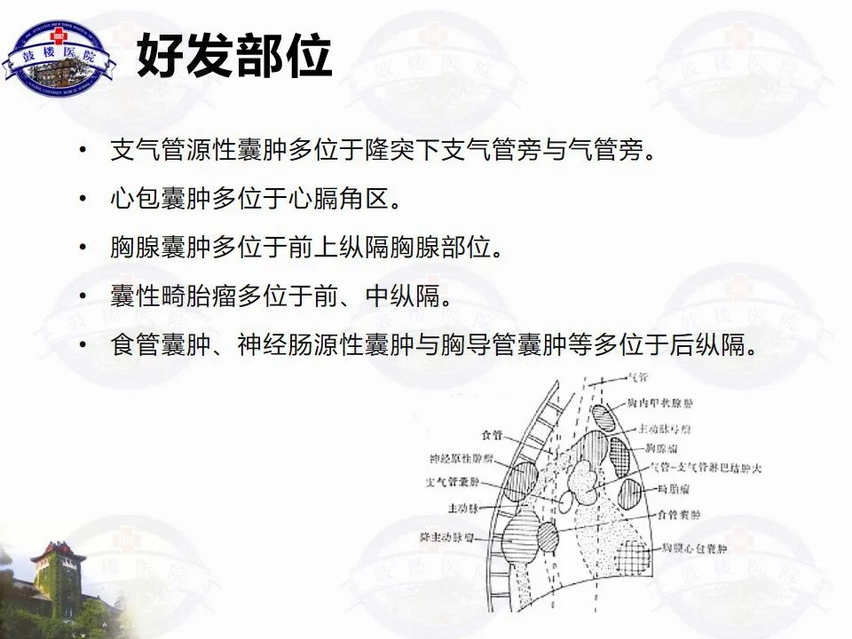 影像PPT - 【PPT】纵隔囊性病变CT诊断-13