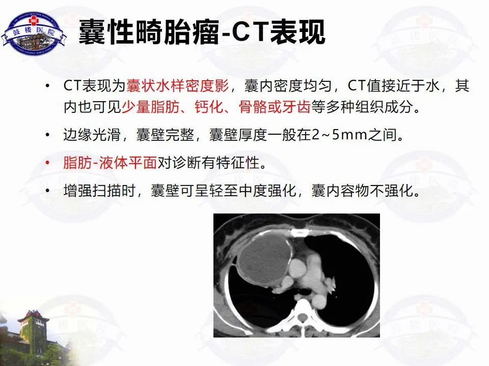 影像PPT - 【PPT】纵隔囊性病变CT诊断-17