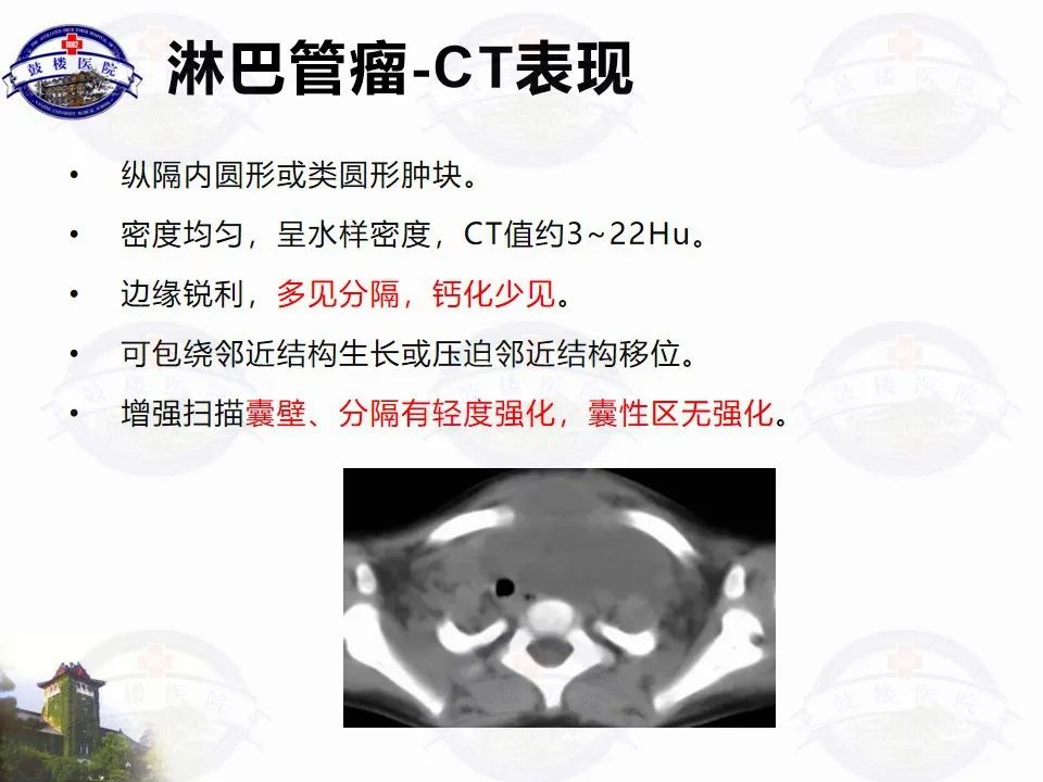 影像PPT - 【PPT】纵隔囊性病变CT诊断-23