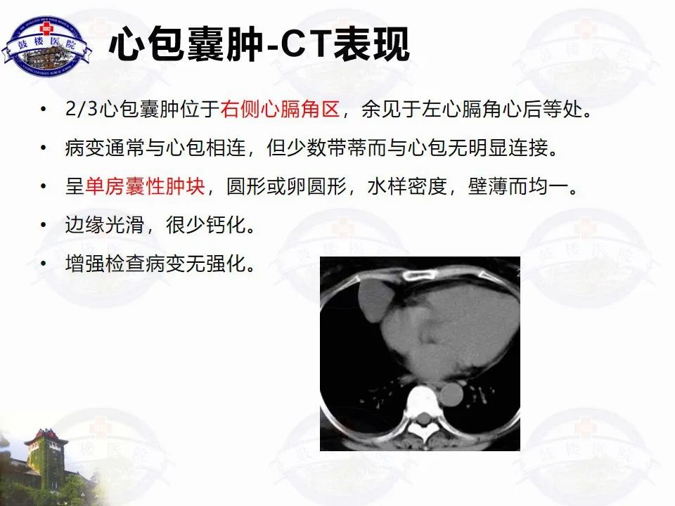 影像PPT - 【PPT】纵隔囊性病变CT诊断-25