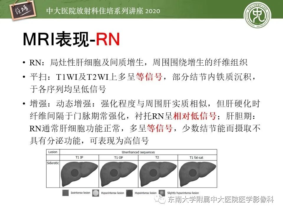影像PPT - 【PPT】肝脏MR特异性对比剂的临床应用-15