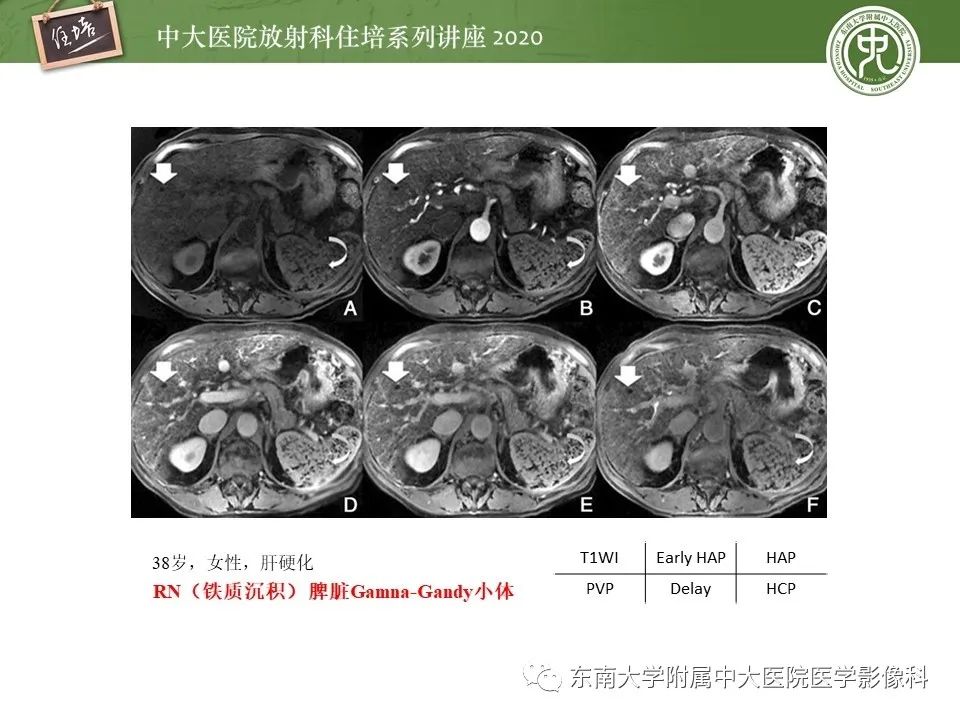 影像PPT - 【PPT】肝脏MR特异性对比剂的临床应用-16