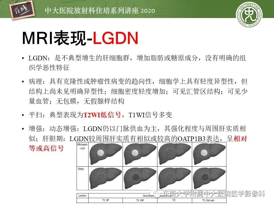 影像PPT - 【PPT】肝脏MR特异性对比剂的临床应用-17