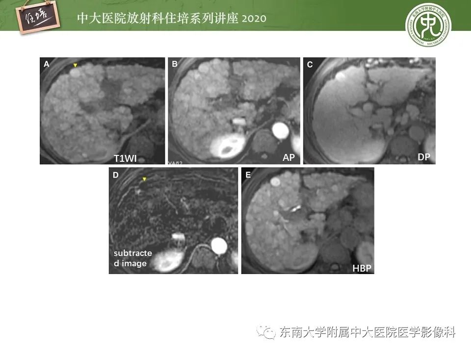 影像PPT - 【PPT】肝脏MR特异性对比剂的临床应用-18