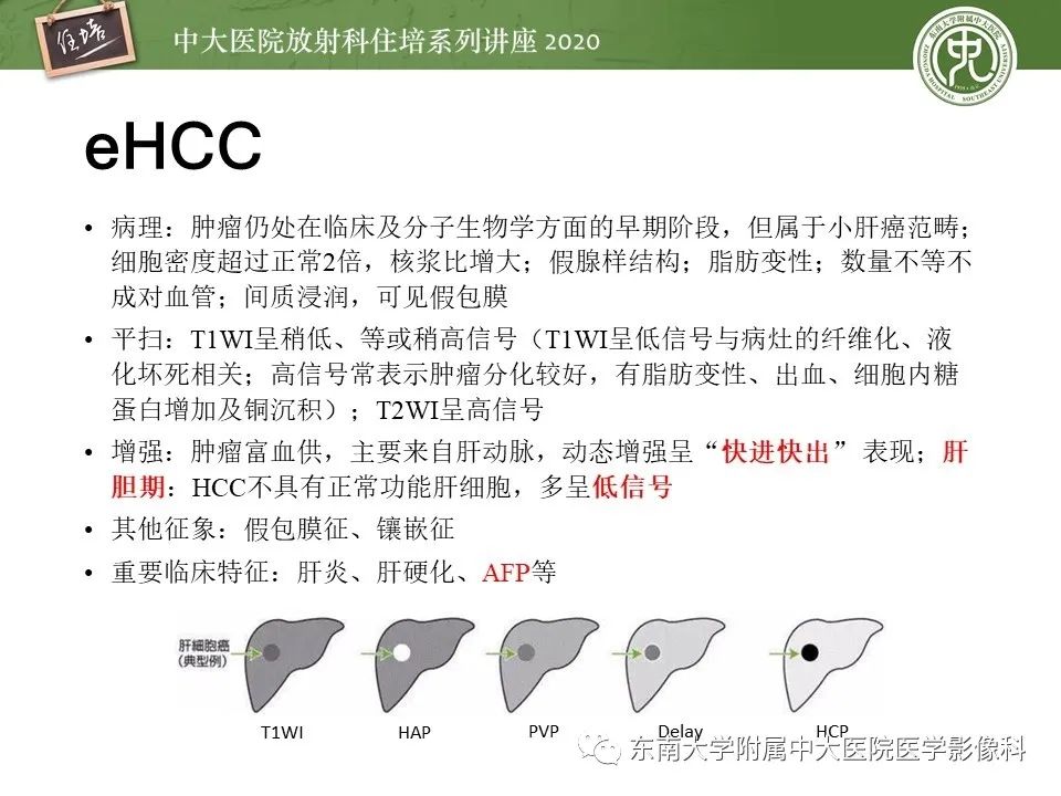 影像PPT - 【PPT】肝脏MR特异性对比剂的临床应用-21