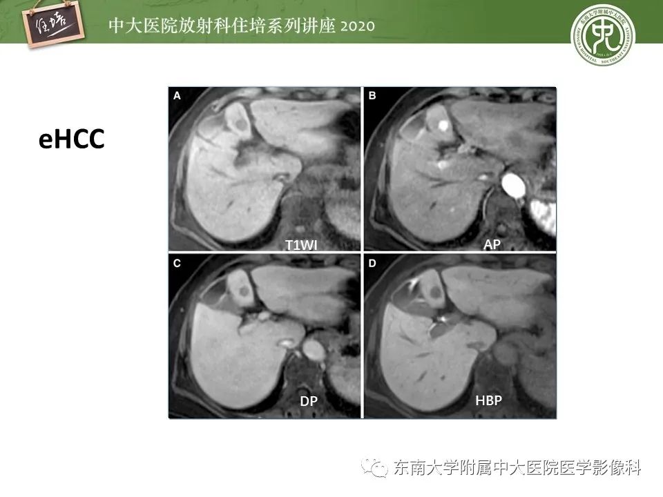 影像PPT - 【PPT】肝脏MR特异性对比剂的临床应用-23