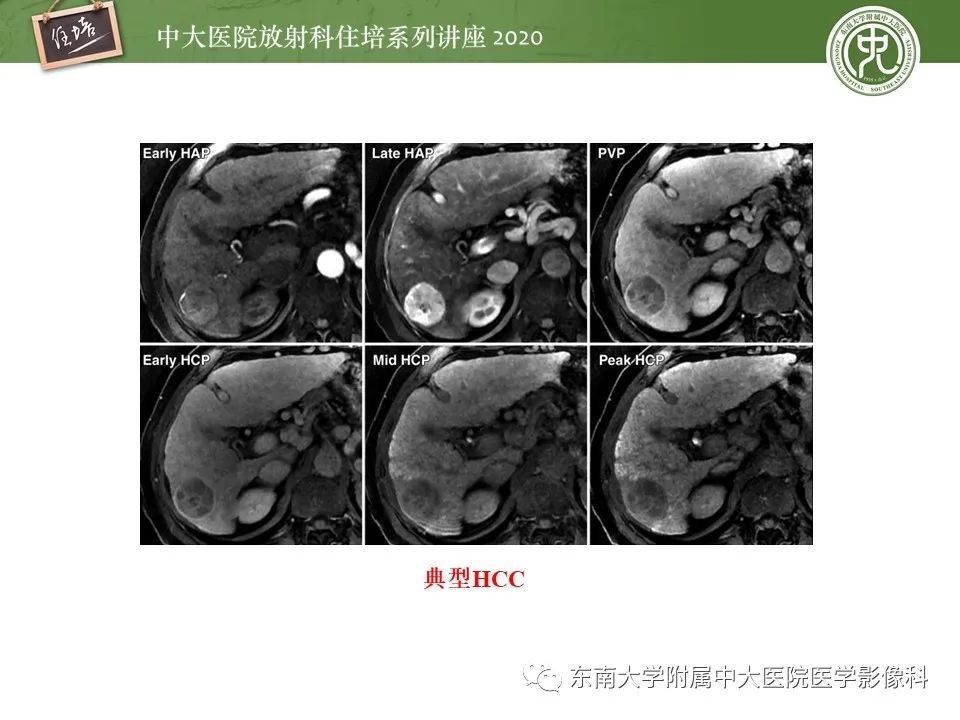 影像PPT - 【PPT】肝脏MR特异性对比剂的临床应用-24