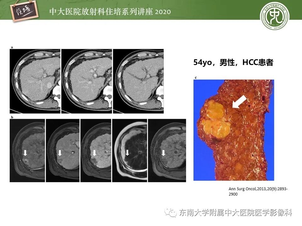 影像PPT - 【PPT】肝脏MR特异性对比剂的临床应用-27