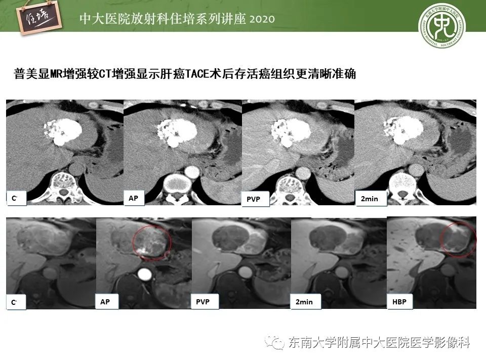 影像PPT - 【PPT】肝脏MR特异性对比剂的临床应用-32