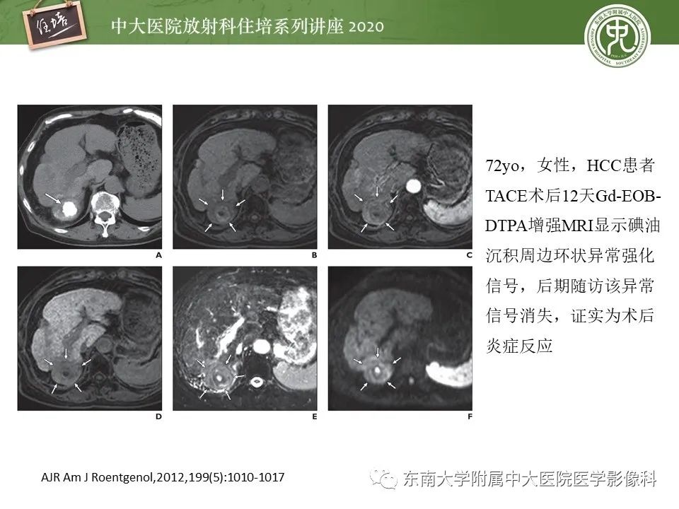 影像PPT - 【PPT】肝脏MR特异性对比剂的临床应用-33