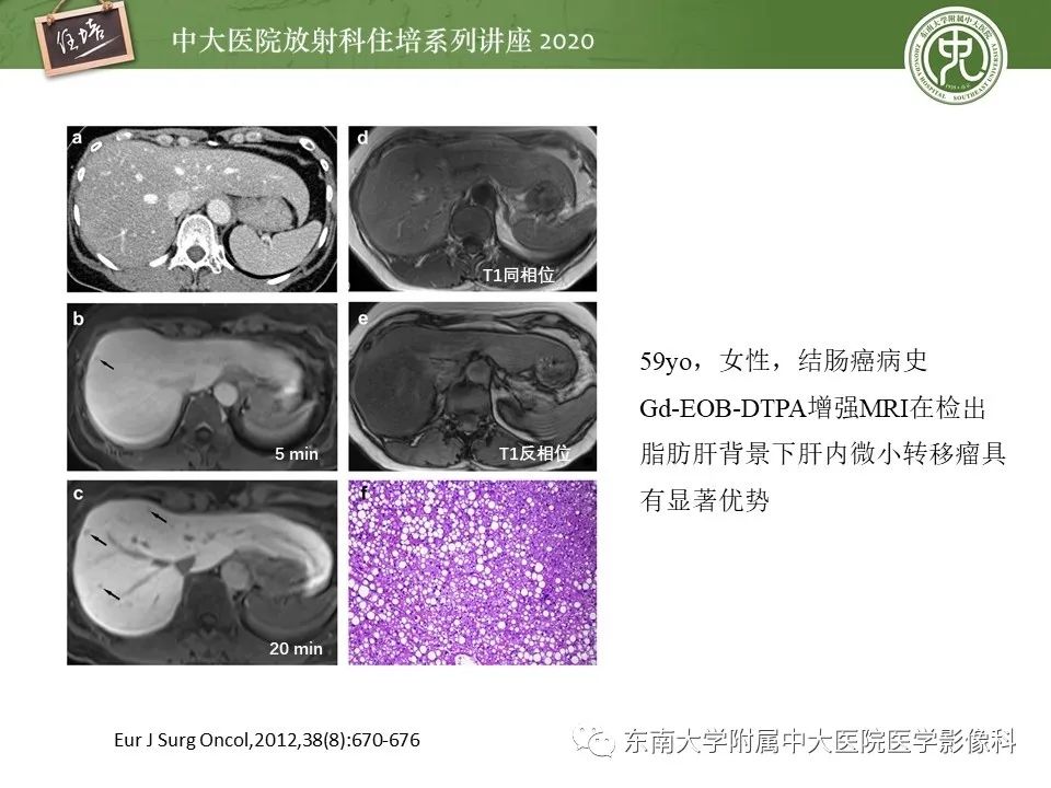 影像PPT - 【PPT】肝脏MR特异性对比剂的临床应用-35