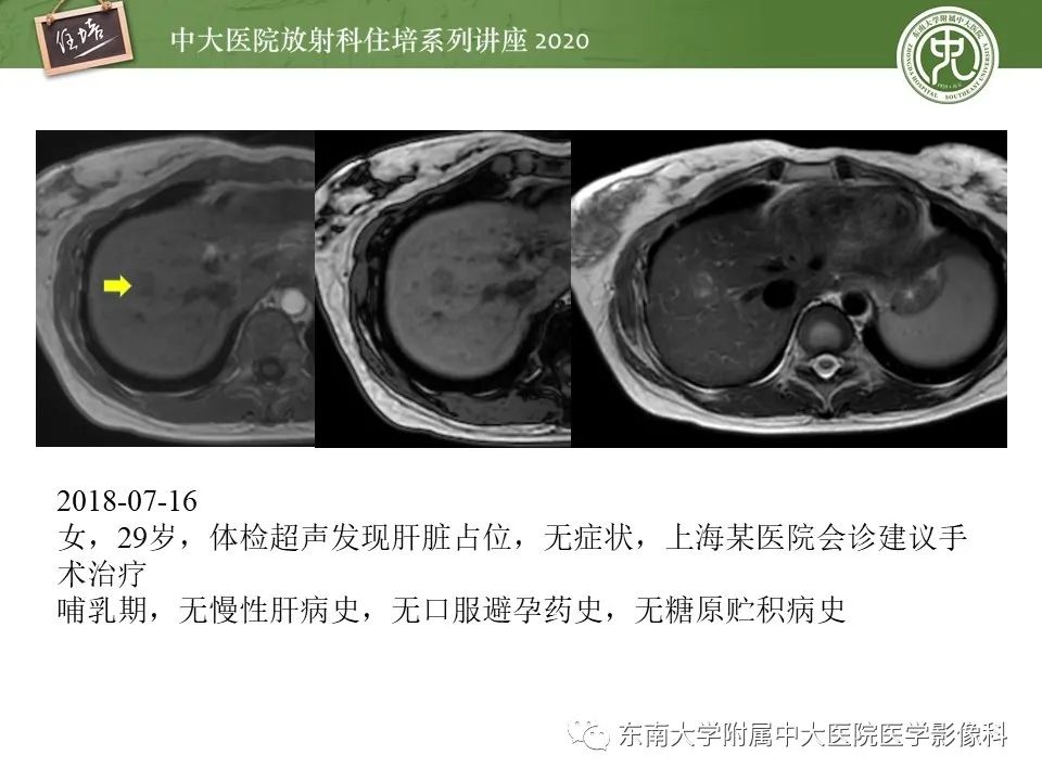 影像PPT - 【PPT】肝脏MR特异性对比剂的临床应用-41