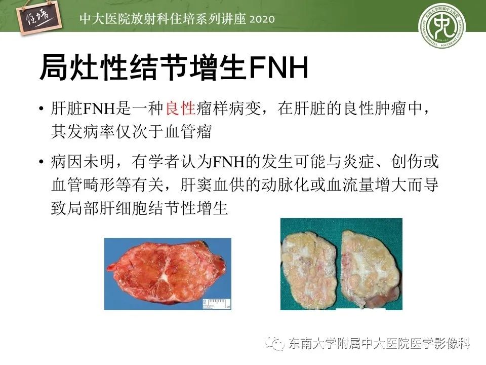 影像PPT - 【PPT】肝脏MR特异性对比剂的临床应用-46
