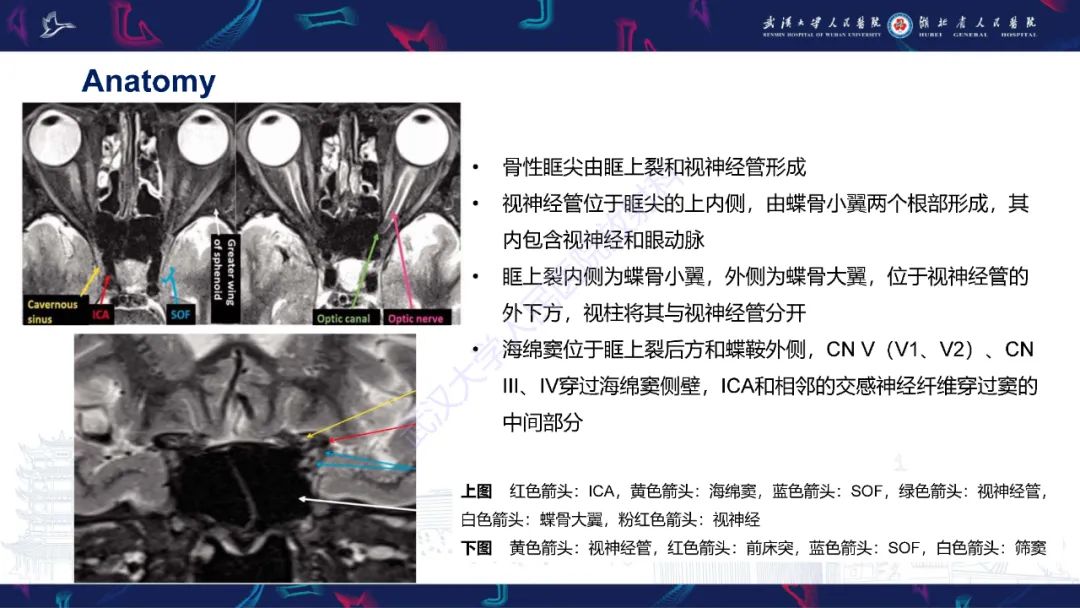 影像PPT - 【PPT】眶尖疾病影像诊断-4