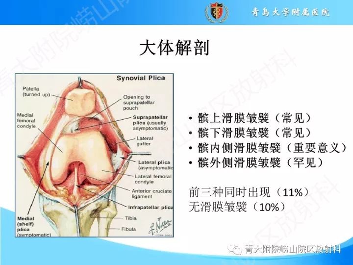 影像PPT - 【PPT】膝关节滑膜皱襞-4