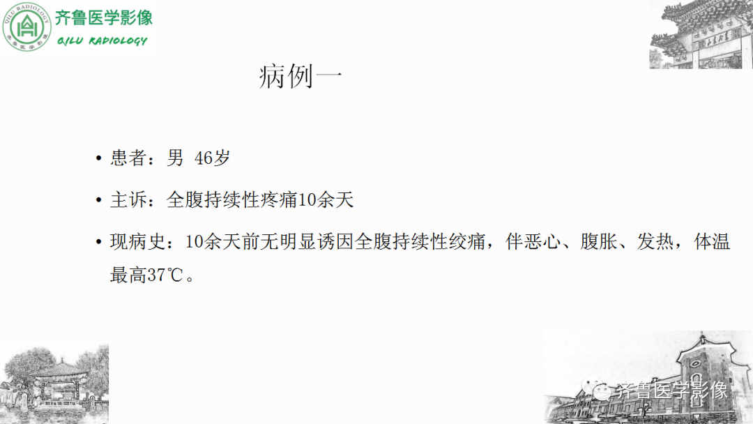 影像PPT - 【PPT】肠套叠-3