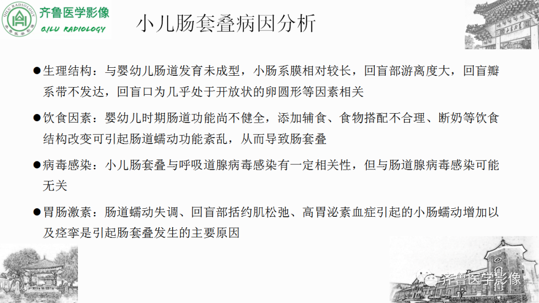 影像PPT - 【PPT】肠套叠-11