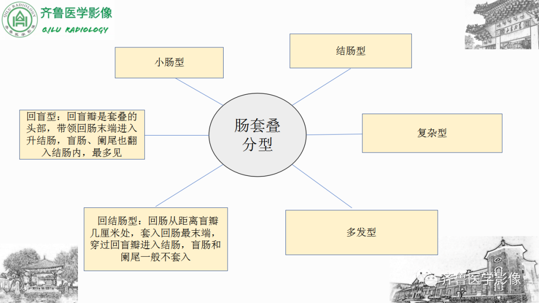 影像PPT - 【PPT】肠套叠-13