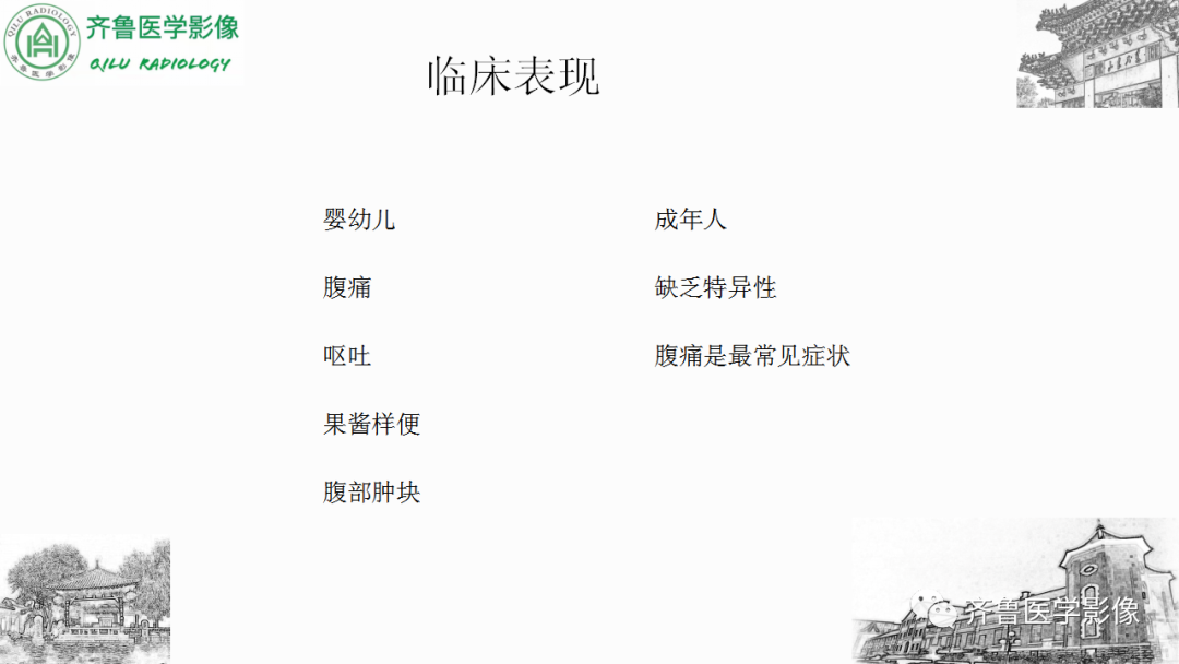 影像PPT - 【PPT】肠套叠-15