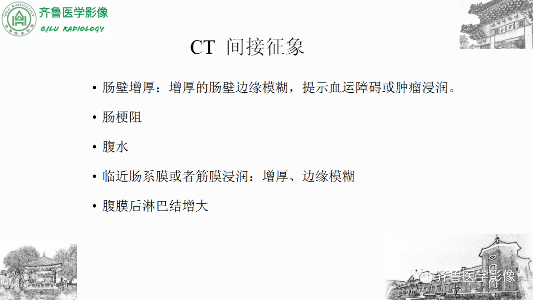 影像PPT - 【PPT】肠套叠-21