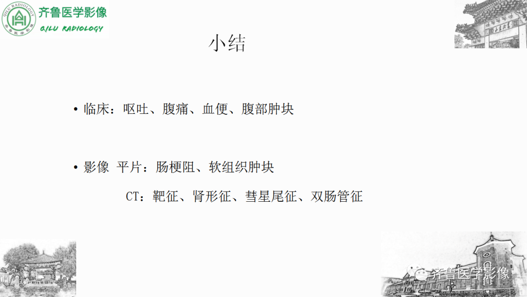 影像PPT - 【PPT】肠套叠-23