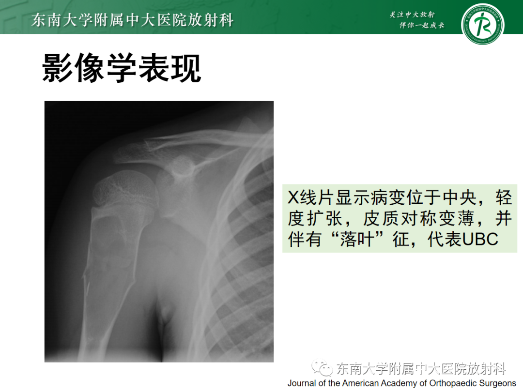 影像PPT - 【PPT】骨巨细胞瘤-23