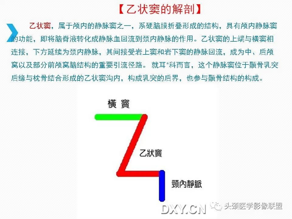 影像PPT - 【PPT】乙状窦憩室再认识-19