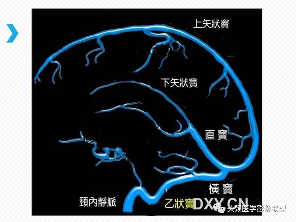 影像PPT - 【PPT】乙状窦憩室再认识-24