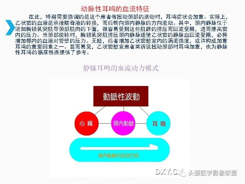 影像PPT - 【PPT】乙状窦憩室再认识-35