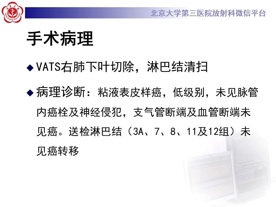 影像PPT - 【PPT】肺粘液表皮样癌-7