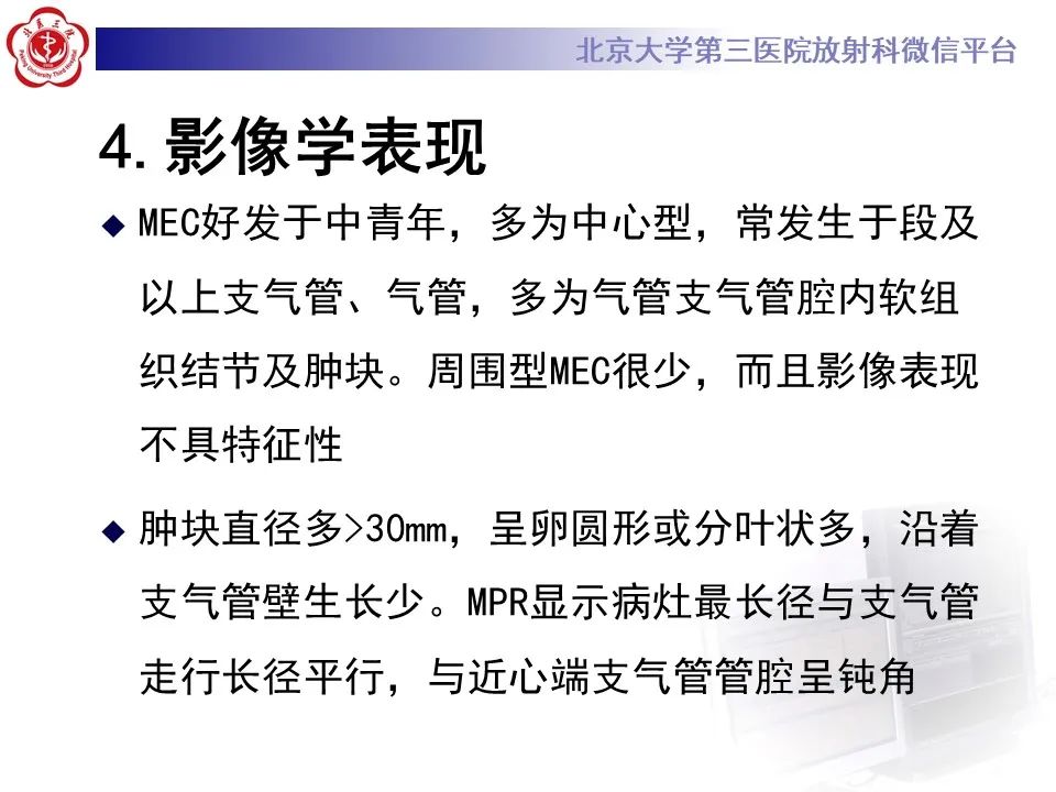 影像PPT - 【PPT】肺粘液表皮样癌-16
