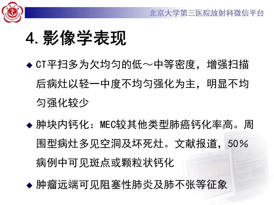 影像PPT - 【PPT】肺粘液表皮样癌-17