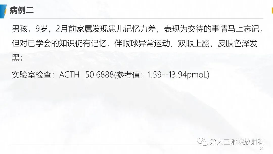 影像PPT - 【PPT】肾上腺脑白质营养不良的影像诊断-20