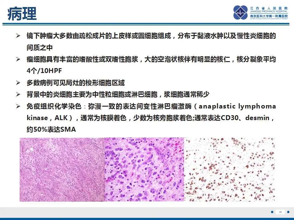 影像PPT - 【PPT】上皮样炎性肌纤维母细胞肉瘤-21
