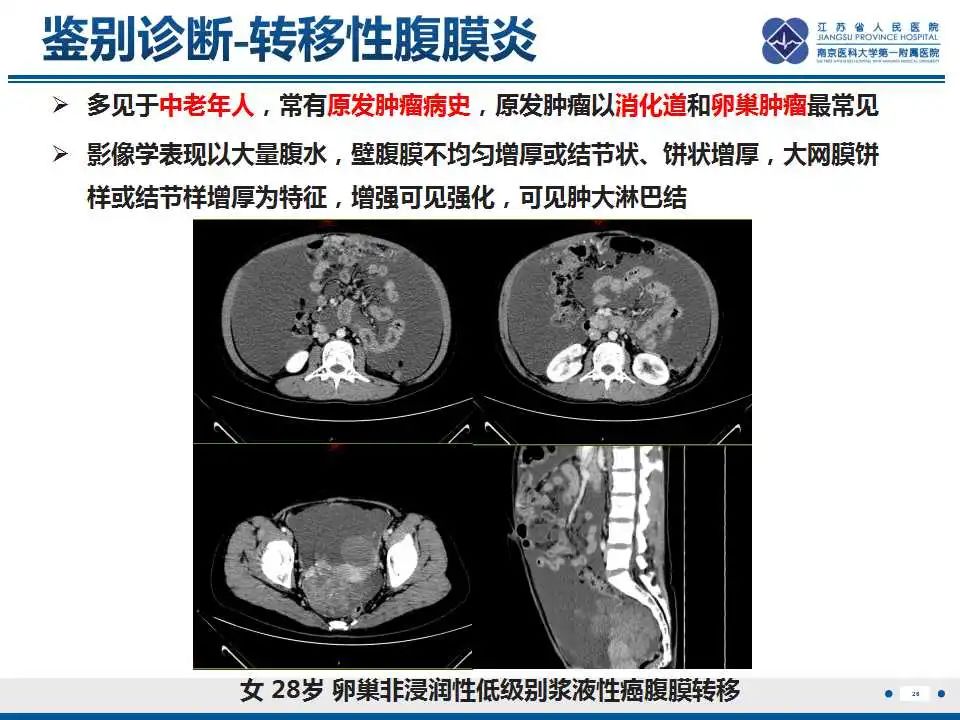 影像PPT - 【PPT】上皮样炎性肌纤维母细胞肉瘤-27