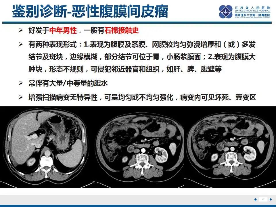 影像PPT - 【PPT】上皮样炎性肌纤维母细胞肉瘤-28