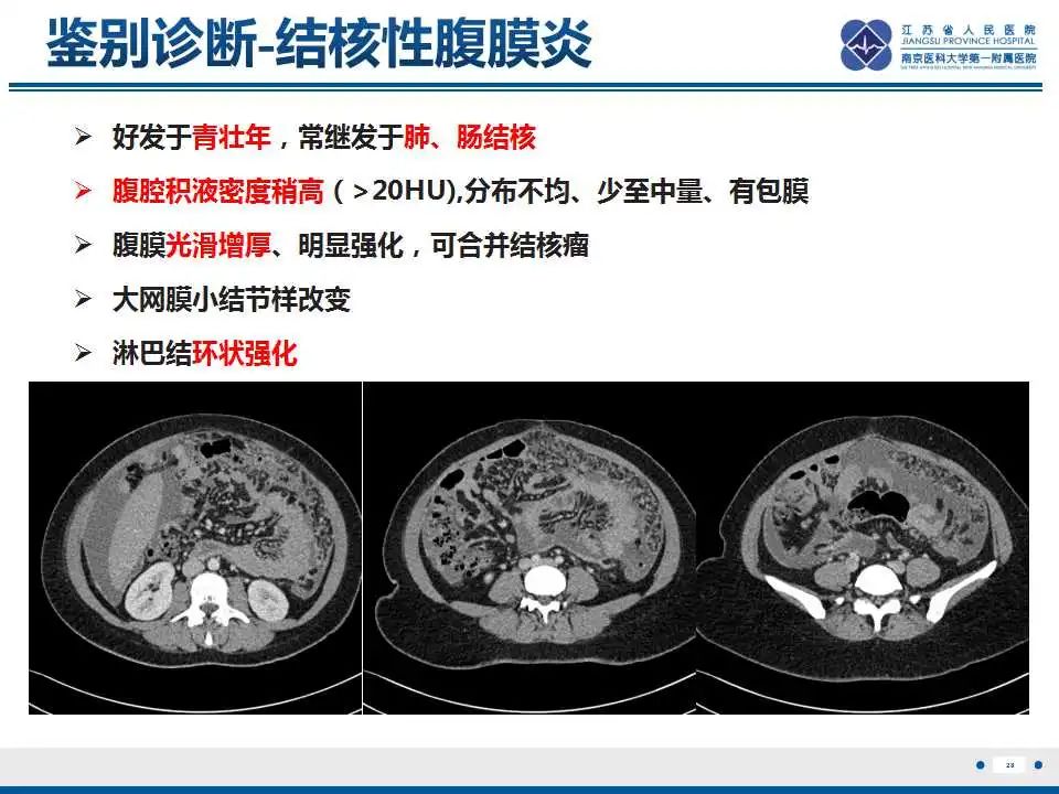 影像PPT - 【PPT】上皮样炎性肌纤维母细胞肉瘤-29