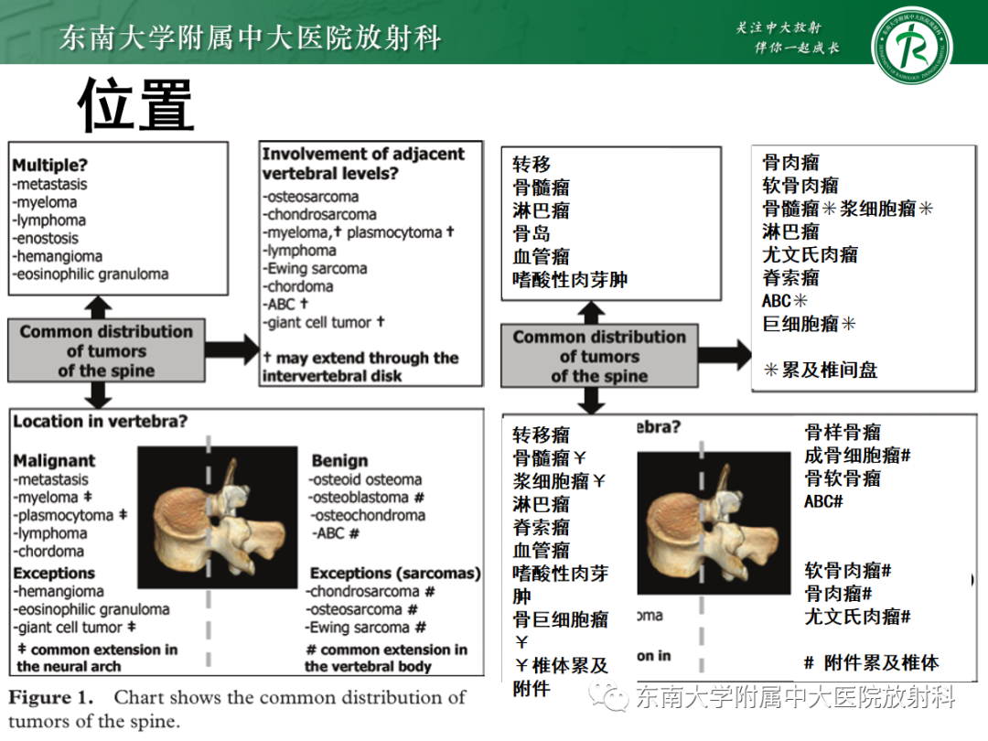 影像PPT - 【PPT】椎体孤立性肿瘤的诊断思路-46 影像PPT - 【PPT】椎体孤立性肿瘤的诊断思路-46