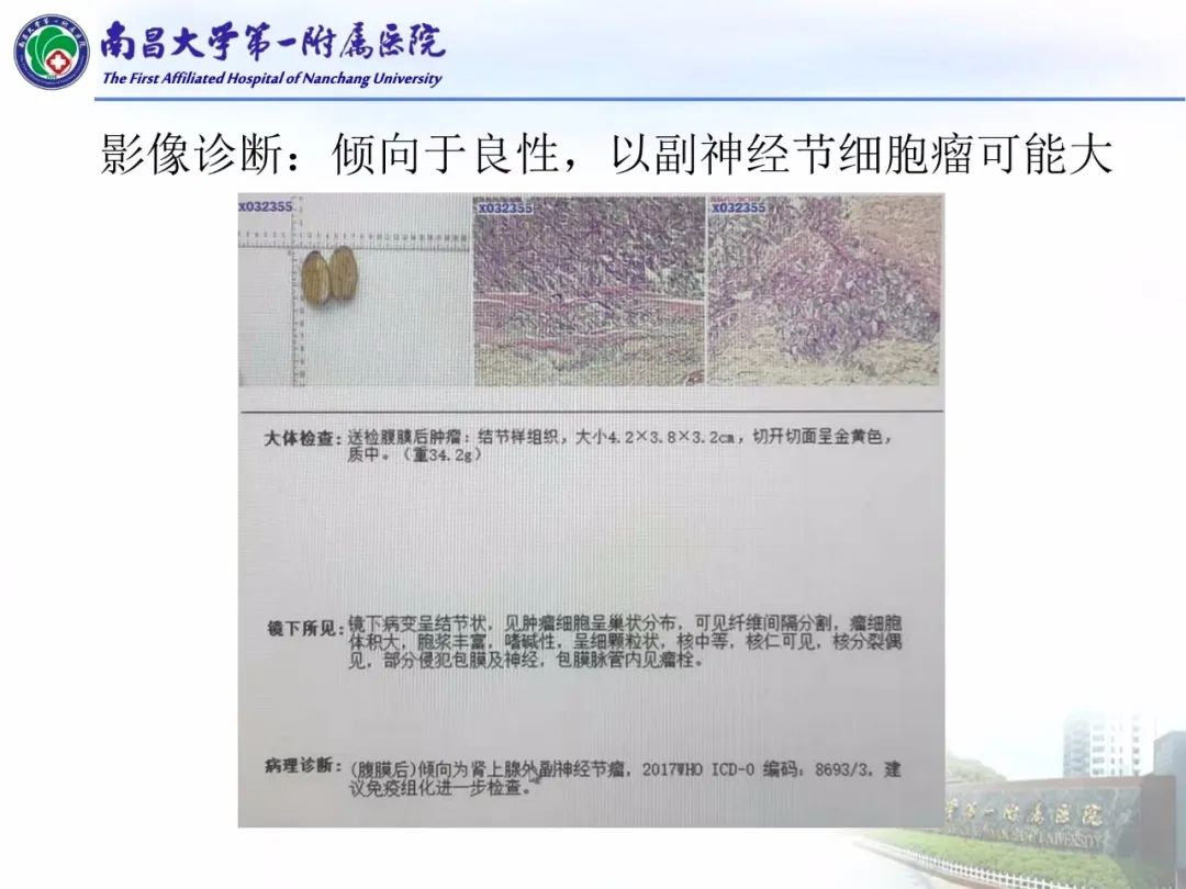 影像PPT - 【PPT】常见腹膜后肿瘤的诊断及鉴别诊断-7