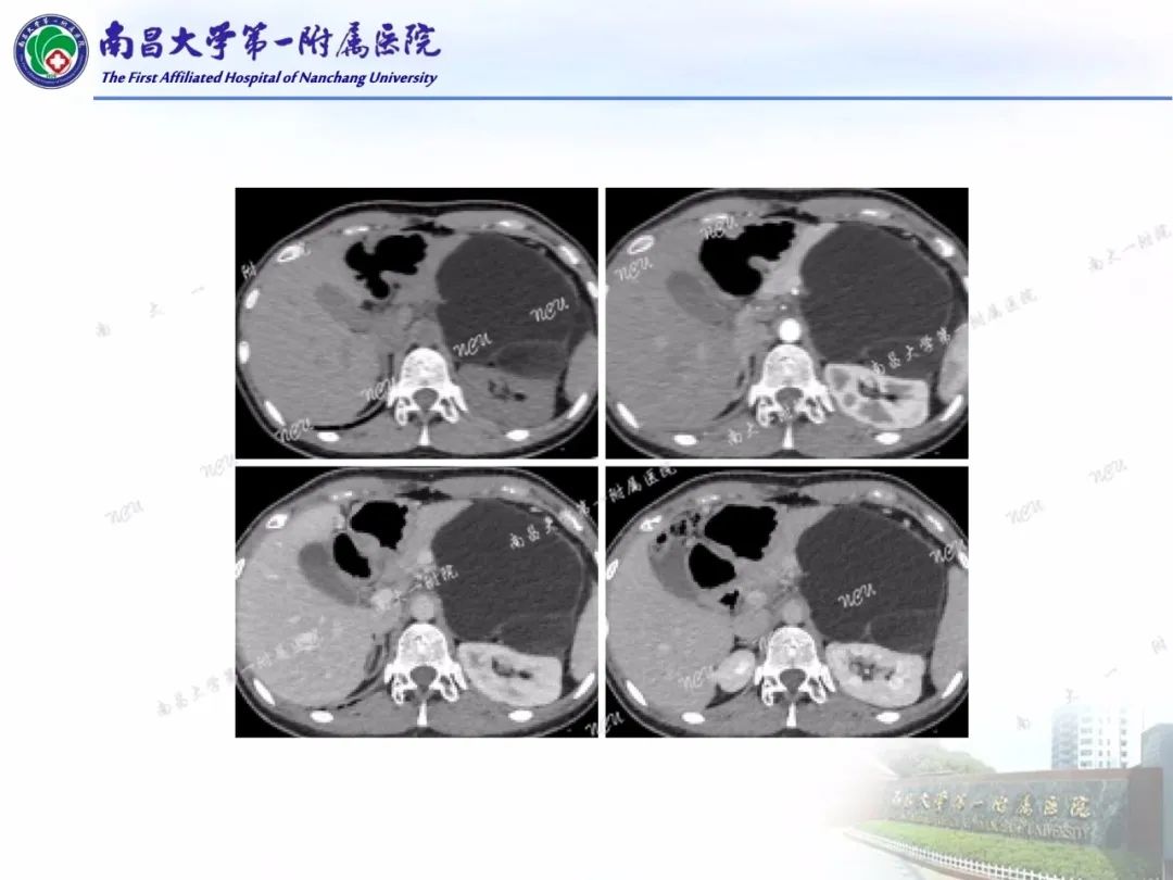 影像PPT - 【PPT】常见腹膜后肿瘤的诊断及鉴别诊断-9