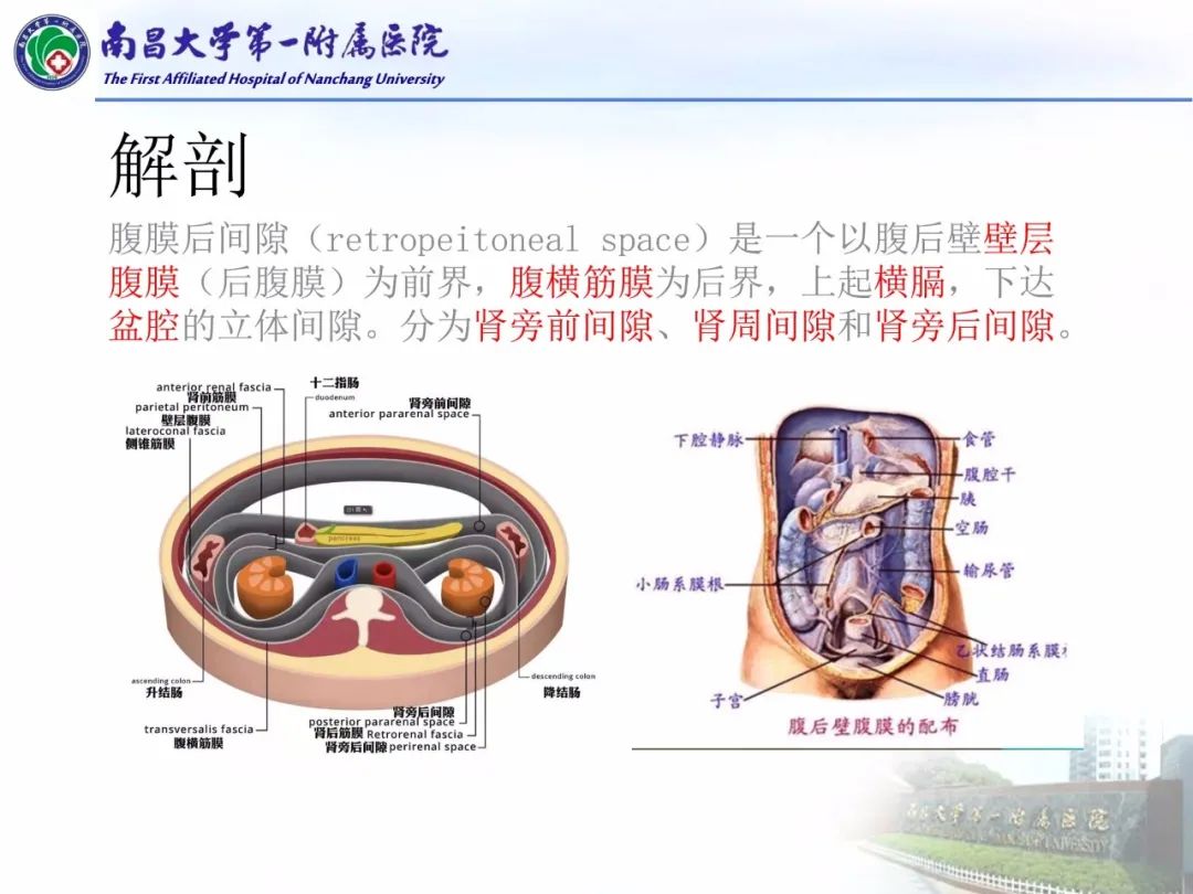 影像PPT - 【PPT】常见腹膜后肿瘤的诊断及鉴别诊断-20