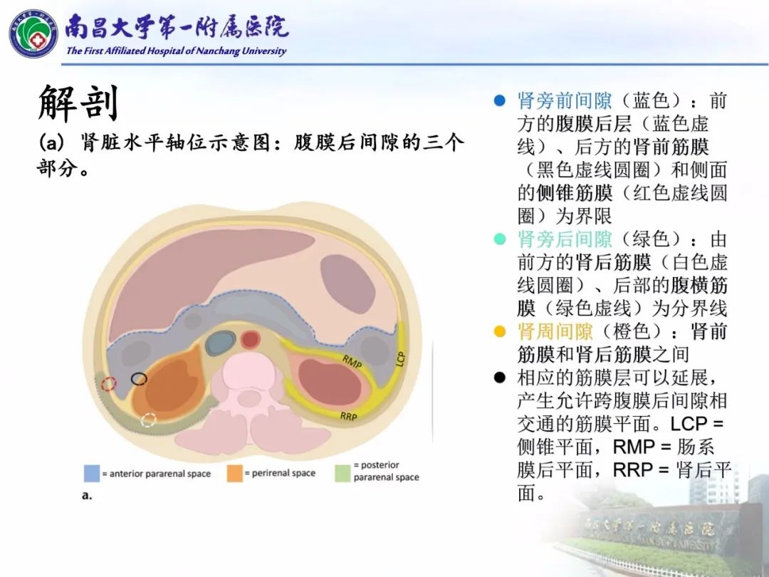 影像PPT - 【PPT】常见腹膜后肿瘤的诊断及鉴别诊断-21
