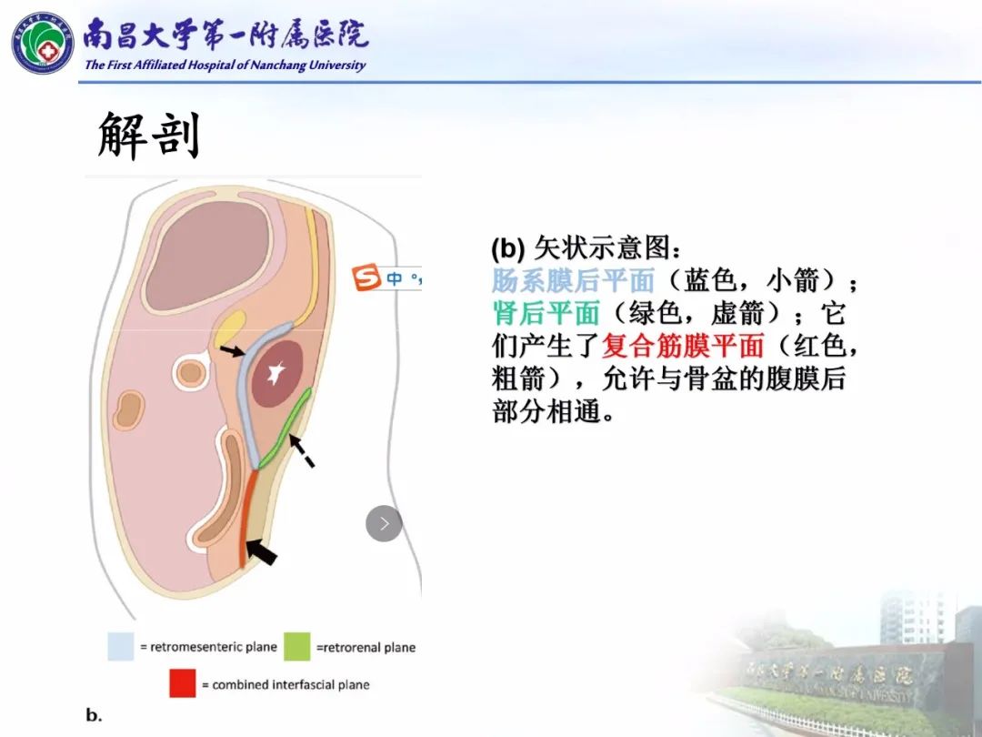 影像PPT - 【PPT】常见腹膜后肿瘤的诊断及鉴别诊断-22