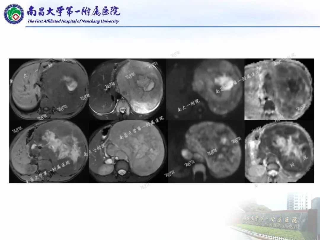 影像PPT - 【PPT】常见腹膜后肿瘤的诊断及鉴别诊断-63